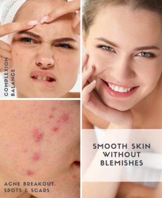 Blemish Control Expert Acne Treatment Serum Illustration