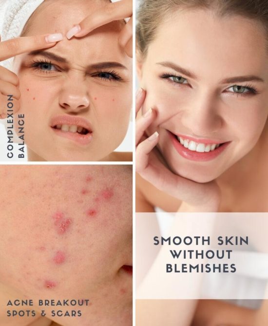 Blemish Control Expert Acne Treatment Serum 1 fl oz