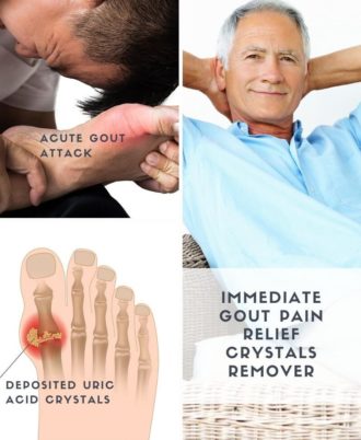 Gout Pain Relief Crystals Removal Ointment Illustration