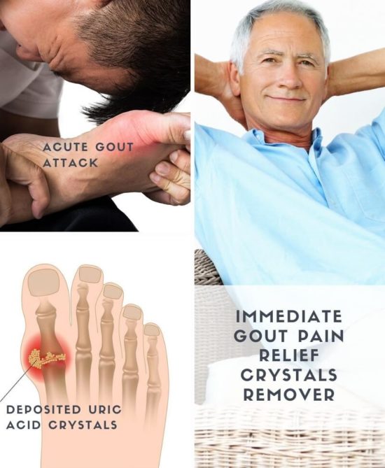 Gout Pain Relief & Crystals Removal Fast-Acting Topical Treatment