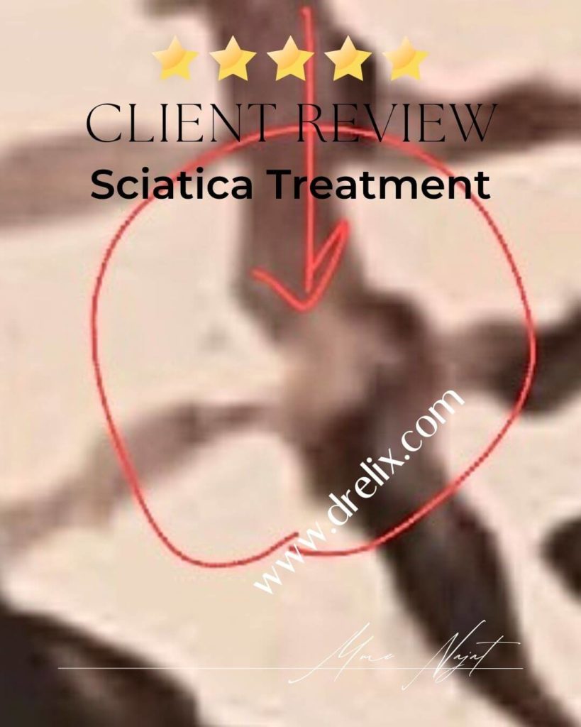 Sciatica relief client review Dr Elix 3
